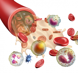 ASCVD: Signifikante Senkung des LDL-Cholesterin unter Bempedoinsäure